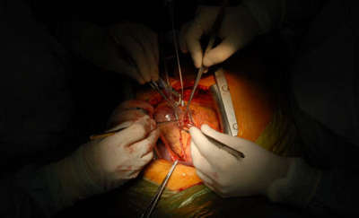 Ogólnopolski Dzień Transplantacji