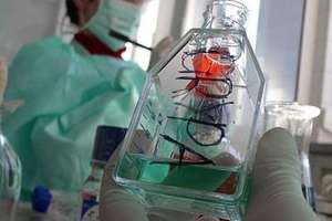 W iławskim szpitalu zmarł mężczyzna zarażony AH1N1
