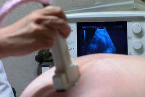 Pro-Medica z dofinansowaniem na aparat USG i wymianę mammografu
