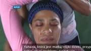 Kobieta z Dominikany płacze "krwawymi łzami"