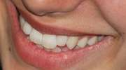 Naukowcy opracowali nową metodę regeneracji zębów. Koniec z leczeniem kanałowym?