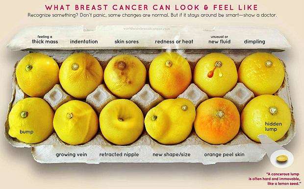 Poznaj swoje cytryny! Ciekawa akcja poświęcona rakowi piersi - full image