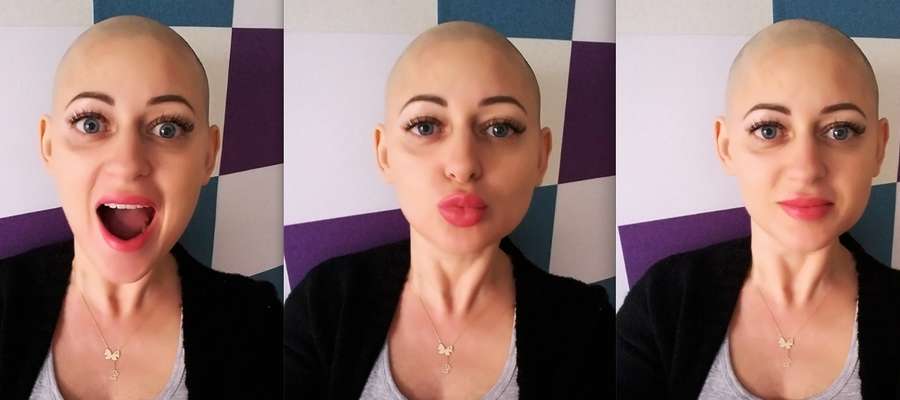 Anetta Szczepińska tuż po ścięciu włosów przed chemioterapią
