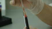 Pacjent stacji dializ w Olsztynie zakażony koronawirusem
