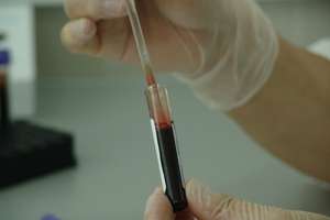Pacjent stacji dializ w Olsztynie zakażony koronawirusem