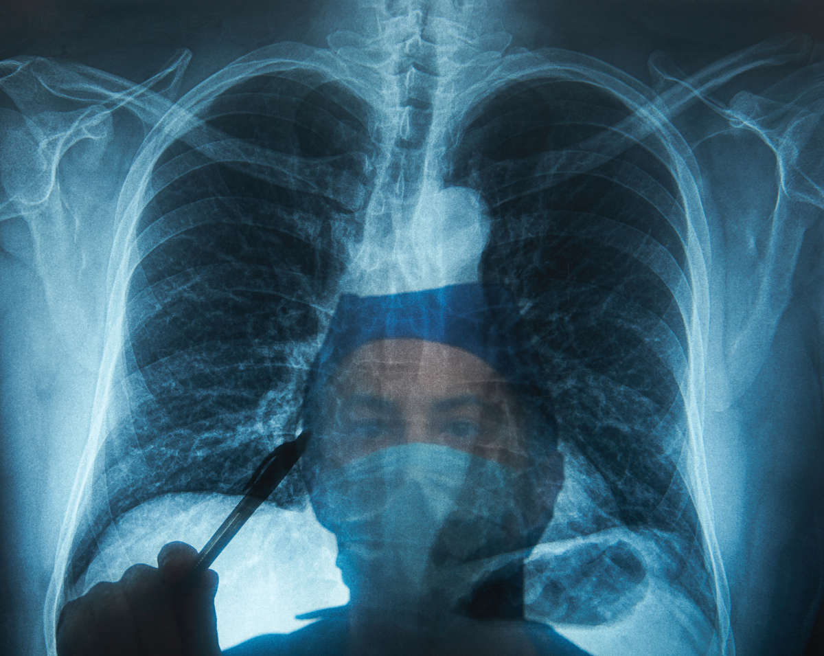 W Polsce co 20 minut ktoś umiera na raka płuca. Szybka diagnostyka i leczenie mogłyby poprawić te statystyki - full image