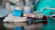 Koronawirus:  W warmińsko-mazurskim prawie 1000 nowych zachorowań