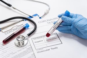 Koronawirus w Polsce: nie żyje 6 kolejnych osób, 117 nowych zakażeń