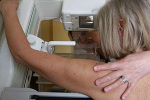 Badania mammograficzne dla kobiet w wieku 50 - 69 lat