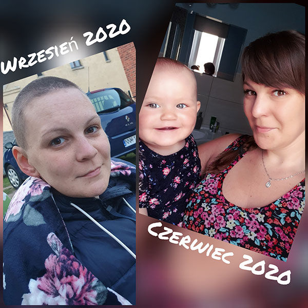Anna Szwinge z córeczką; przez chemię wypadły jej włosy  