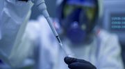 Prawie połowa wykonanych wczoraj testów była pozytywna