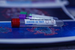 Koronawirus: spadek liczby zakażeń, zgonów i szczepień