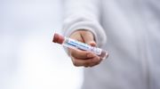 Dane epidemiczne za 02.04.2021