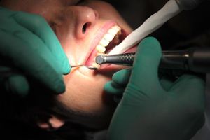 Nowe zęby dzięki inżynierii tkankowej