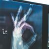 "Zmierz się" - kampania informacyjna o osteoporozie