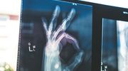 "Zmierz się" - kampania informacyjna o osteoporozie
