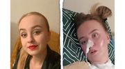 Wypadek zabrał Martynie marzenia, ale nie przyszłość… Pomóżmy jej wrócić do zdrowia!