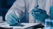 Wrocławscy naukowcy opracowali przełomową metodę niszczenia komórek nowotworowych