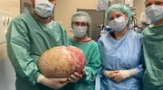 Gigantyczny guz wycięty w elbląskim szpitalu