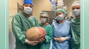 Niewiarygodny ciężar. Lekarze z Elbląga usunęli pacjentce 20-kilogramowy guz jajnika
