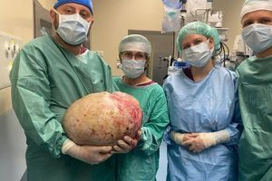 Gigantyczny guz wycięty w elbląskim szpitalu