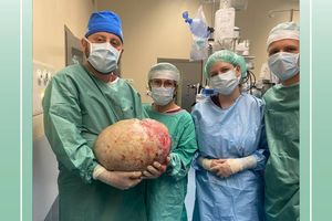 Niewiarygodny ciężar. Lekarze z Elbląga usunęli pacjentce 20-kilogramowy guz jajnika